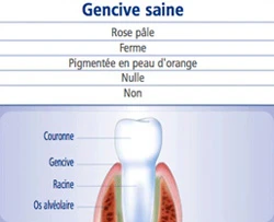 gencive saine